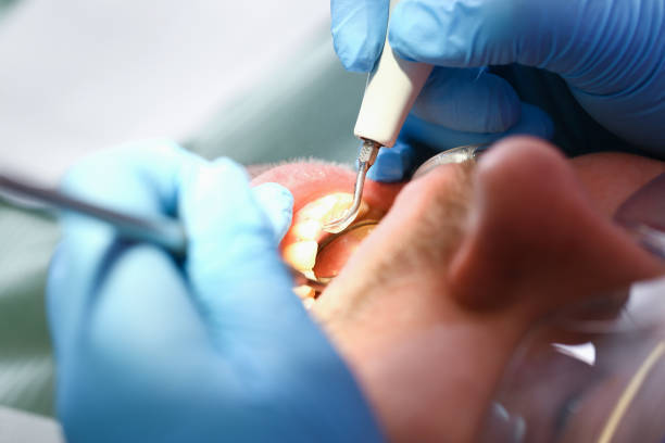 Best Emergency Tooth Extraction in Bunker Hill Village, TX